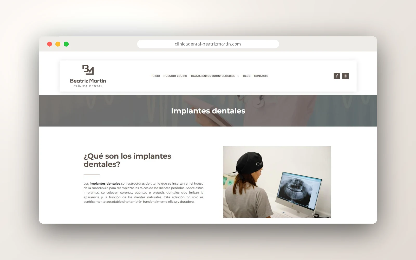 Página de implantes dentales en la web de la Clínica Dental Beatriz Martín
